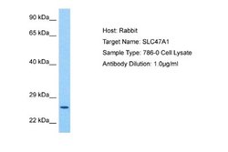 MATE1 Rabbit anti-Human, Polyclonal, Novus Biologicals 0.1ml; Unconjugated:Antibodies,